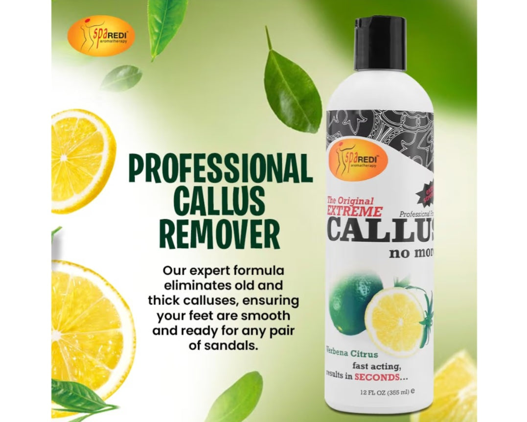 Callus remover