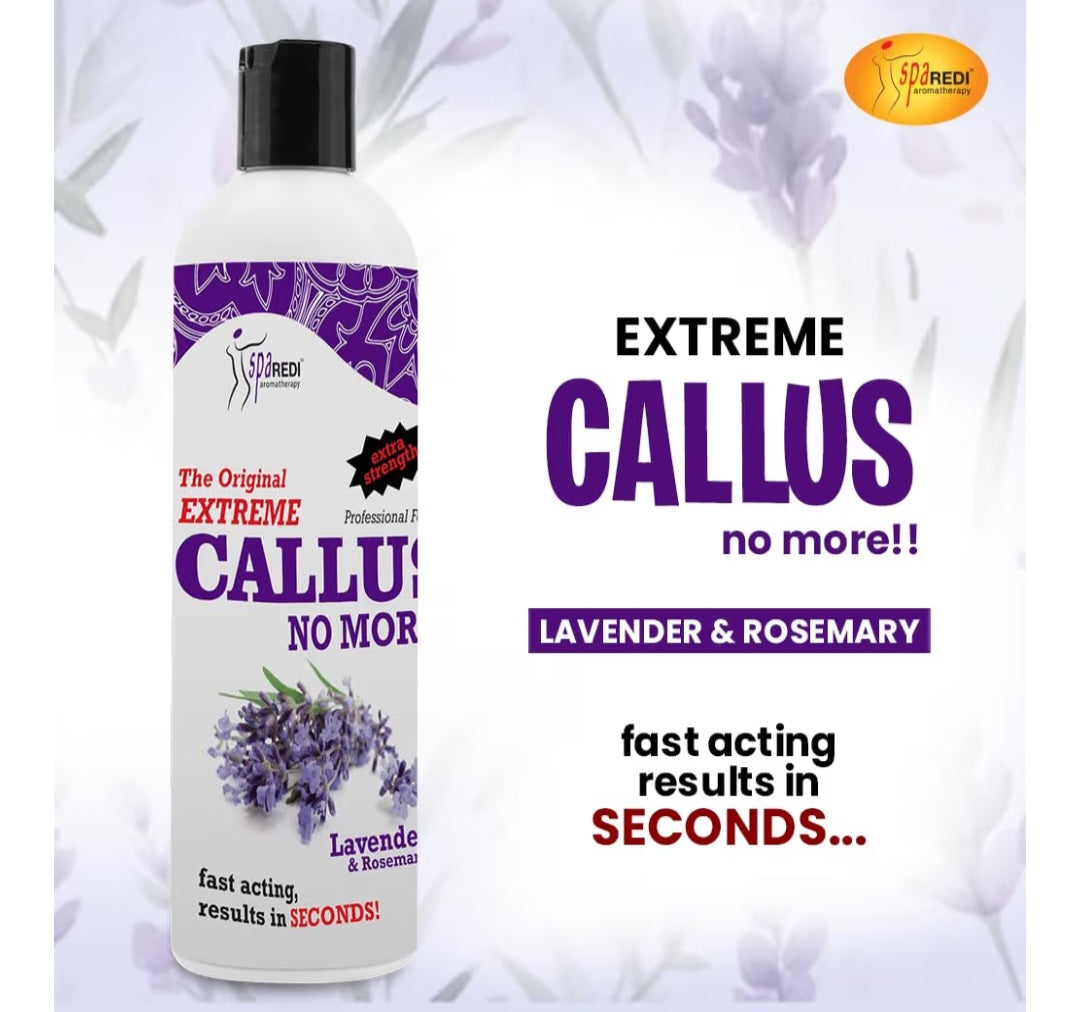 Callus remover