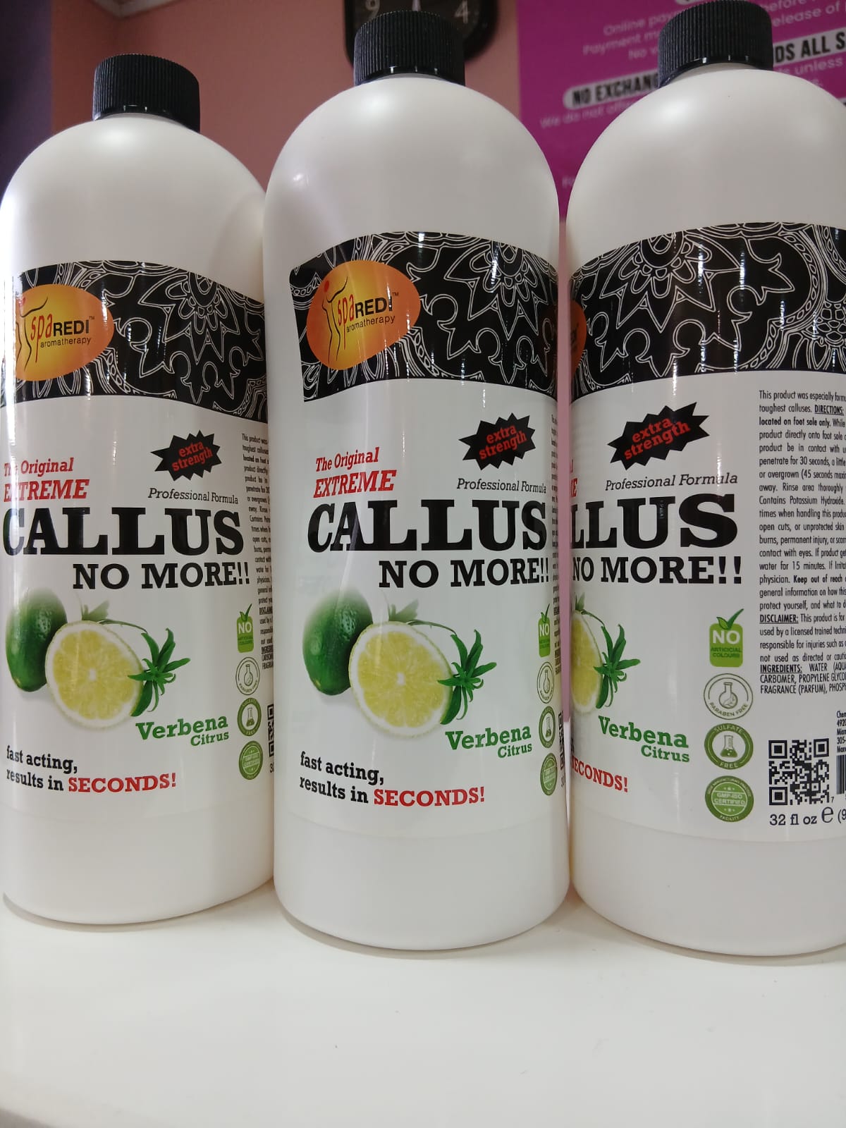 Callus remover